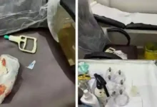 عقوبة ممارسة الحجامة بدون ترخيص في السعودية: تفاصيل جديدة