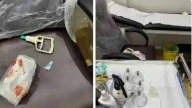 عقوبة ممارسة الحجامة بدون ترخيص في السعودية: تفاصيل جديدة