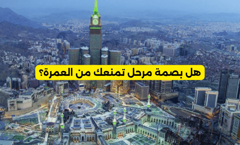 هل بصمة مرحل تمنعك من العمرة؟